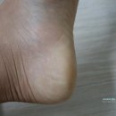 모니슈퍼 이미지