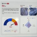 부천두피관리 카리스두피탈모뷰티 두피모발생장케어, 두피진단 및 두피스케일링 솔직후기