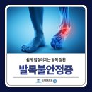 김포발목불안정증 반복적으로 발목이 꺾이고 삐끗한다면 의심해 봐야 하는 이유 이미지