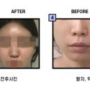 풀페이스의원 이미지