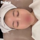 수영구 피부관리 처음이라면 소예 에스테틱 탕후루필