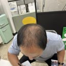 신원로2길 | [고양] 일산 , 서울근교 두피문신 , 탈모 커버 받고 자신감 되찾고 싶으면 &#34;글램유SMP&#34;