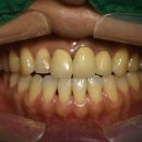 멍크라운 이미지