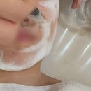 윤스 | 광명피부관리 윤스뷰티 일직동에스테틱 물방울 리프팅 후기