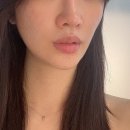 세리영 스킨케어 | [중랑 피부관리] 세리영 스킨케어에서 물방울리프팅 후기 :)