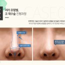 눈높이성형외과 이미지