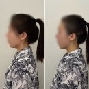 배곧 에스테틱 두피스칼핏관리로 얼굴 리프팅 효과까지 럽인바디핏