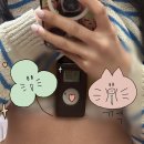 (1) 부정맥 증상부터 시술 전 까지의 이야기 다녀본 심장내과