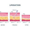 스펀지성형외과의원 이미지