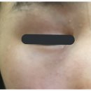 아그네스 | 한관종 아그네스 후기 레이저 효과, 가격까지 솔직 정리