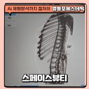 영등포에스테틱 후기, 수술 후 몸도 편안했던 AI 체형케어