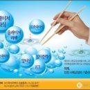 ICL 렌즈삽입술 안내렌즈삽입술 이미지