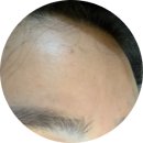 샤론의원 | 목동 피부관리,샤론뷰티에스테틱에서 세멘시트 관리 받고 얼굴 깨끗해졌어요!