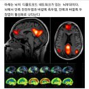 내정상태회로=기본내트워크회로default mode network; DMN 이미지