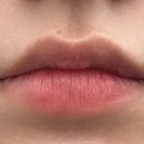 엘츠의원 이미지