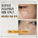 올리지오, 리쥬란힐러, 이마 보톡스 내돈내산 시술 후기 (통증, 효과, 부작용) 분당 파랑새피부과 추천