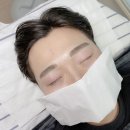 임브로우