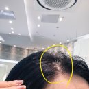 상림빌딩 | 신도림 미용실 / 티틈헤어(titm) 뿌리염색*클리닉 후기