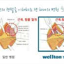 고관절, 엉덩이관절 통증의원인 - 고관절질환의 원인 이미지