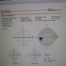 시야검사 두달만에 했어요 이미지