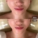 분당 에스테틱 스파나무 정자점 파워리프팅 브이라인 관리 후기