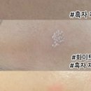 써니스킨케어 이미지