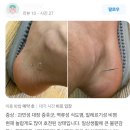 ＜경희 길 한의원＞ 과민성 대장증후군, 역류성식도염, 알레르기성 비염 현재 놀랍게도 많이 호전된 상태 이미지