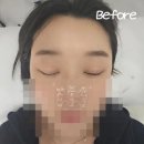 누아쥬뷰티 | [수성구속눈썹맛집] 자연스러운 클래식연장 수성동속눈썹연장 누아쥬뷰티 후기