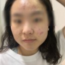 부천아이스피부과의원 이미지