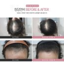 엔비의원 이미지