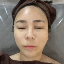 주안 피부관리 웨딩관리 잘하는곳 미본에스테틱 솔직 후기