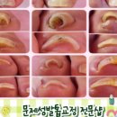 엘커브 이미지