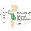 소장의 혈관장애 Vascular disorders of intestine 이미지