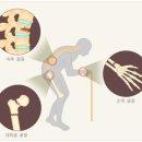 섹칼슘 이미지