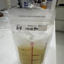 강북구보건소 | 강북구보건소 유축기 대여 후기｜깔대기 준비와 모유저장팩 사용 팁