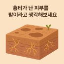 메디레이 | 여드름흉터 치료분류 총정리*개념정리편*_박피성&amp;비박피성레이저/서브시전/TCA도트필/쥬베룩