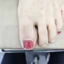 평택센텀정형외과의원 | 평택 내성발톱 무좀 병원에서 체계적인 케어