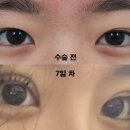 서울성형외과