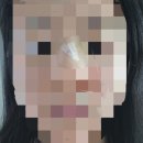 한강연세병원 | 한강 수병원 얼굴 열상 봉합 후기 2