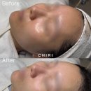 쉼피부관리실피부에휴식을주다 | 구미 문제성피부케어 도넛광케어 치리에스테틱