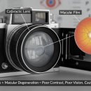 바른안과의원 이미지