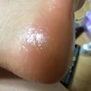 닥터하스킨 이미지