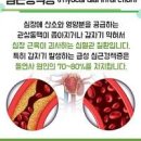 돌연사 전조증상 원인 급성 심근경색 증상 이미지