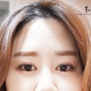 쌍커풀테이프 일본쌍테 디업(D-UP) 솔직후기!