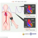 소변난, 배뇨곤란, 빈뇨로 고생하시나요? 이미지