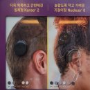 딜라이트보청기(부천점) | 부천보청기 맞춤형 선물