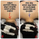 CU(진동사거리점) | 민락역에스테틱 승모근케어 잘하는 금손 에스테틱 찐솔직후기