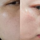 백옥스킨케어 | 멜로스킨 글루타치온 샷 미백앰플 2주 사용 잡티 흔적 케어 후기