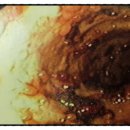 디톡스라이프 이미지