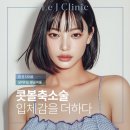 콧볼축소술 후기 만족도 높은 르제이 선택 이유